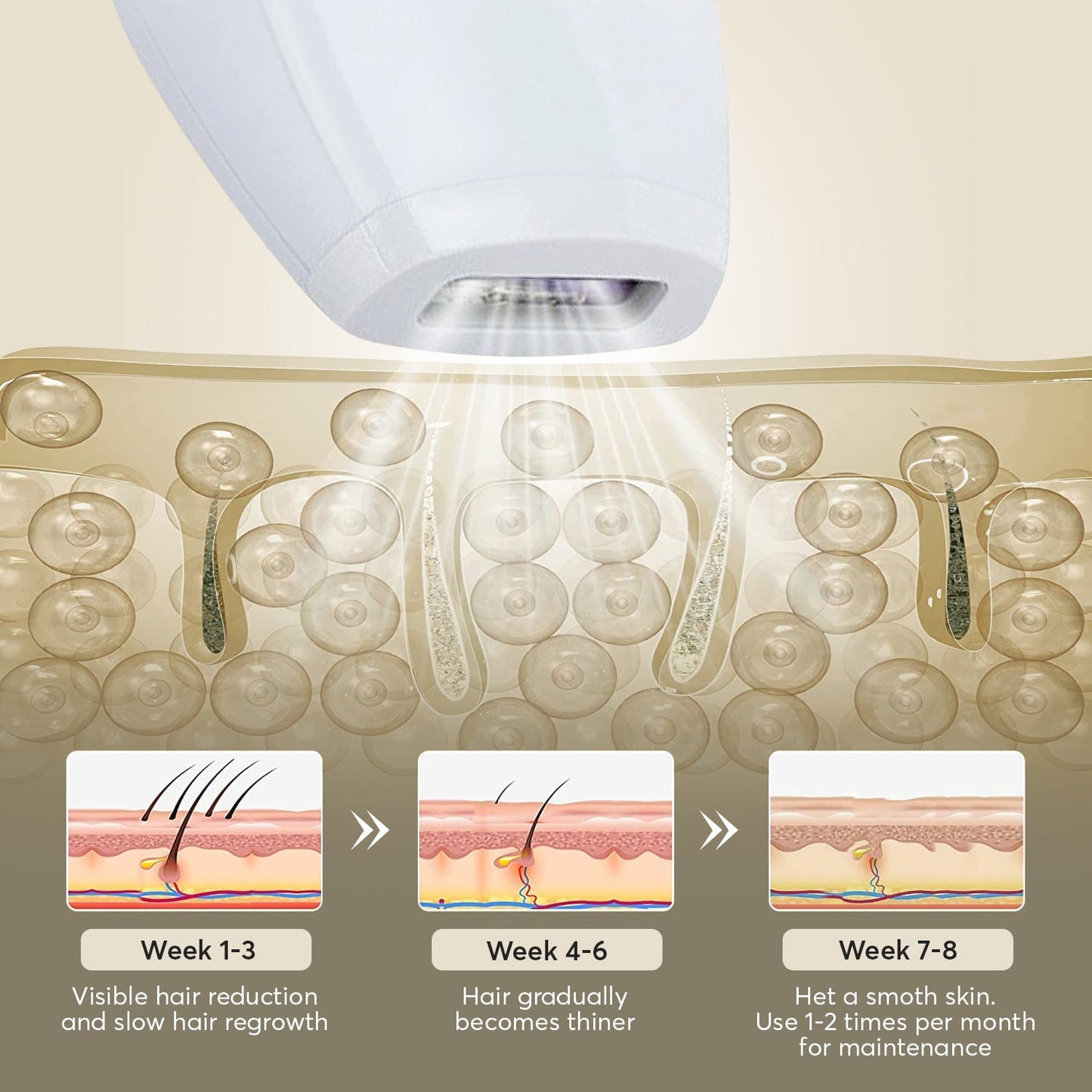 Renelle Radiance IPL