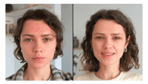 Renelle Glow™  Red Light & Microcurrent Wand
