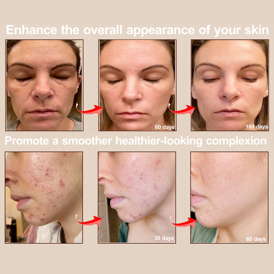 GlowMask Pro Light Therapy